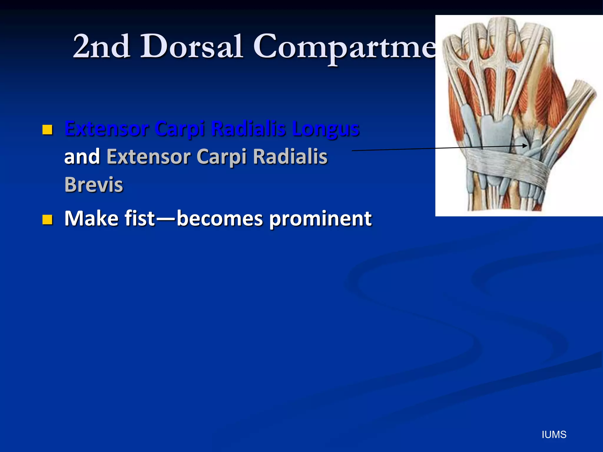 2nd Dorsal Compartment
 Extensor Carpi Radialis Longus
and Extensor Carpi Radialis
Brevis
 Make fist—becomes prominent
IUMS
 