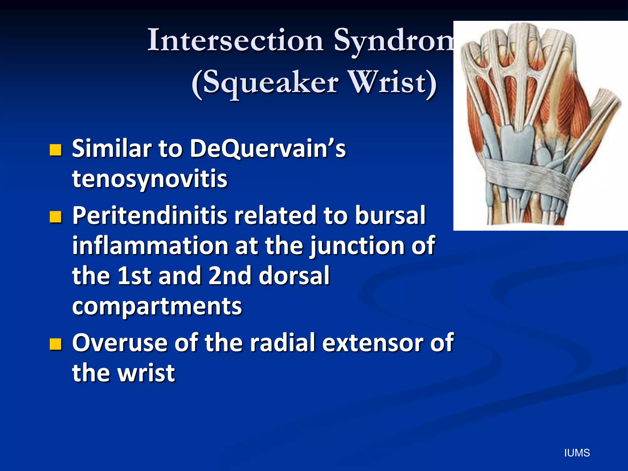 Intersection Syndrome
(Squeaker Wrist)
 Similar to DeQuervain’s
tenosynovitis
 Peritendinitis related to bursal
inflammation at the junction of
the 1st and 2nd dorsal
compartments
 Overuse of the radial extensor of
the wrist
IUMS
 