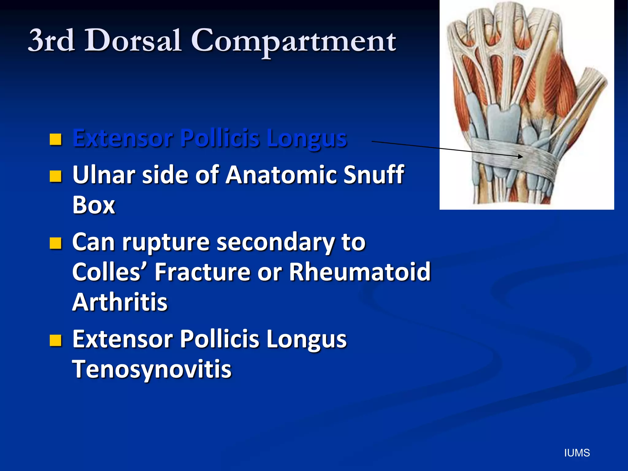 3rd Dorsal Compartment
 Extensor Pollicis Longus
 Ulnar side of Anatomic Snuff
Box
 Can rupture secondary to
Colles’ Fracture or Rheumatoid
Arthritis
 Extensor Pollicis Longus
Tenosynovitis
IUMS
 