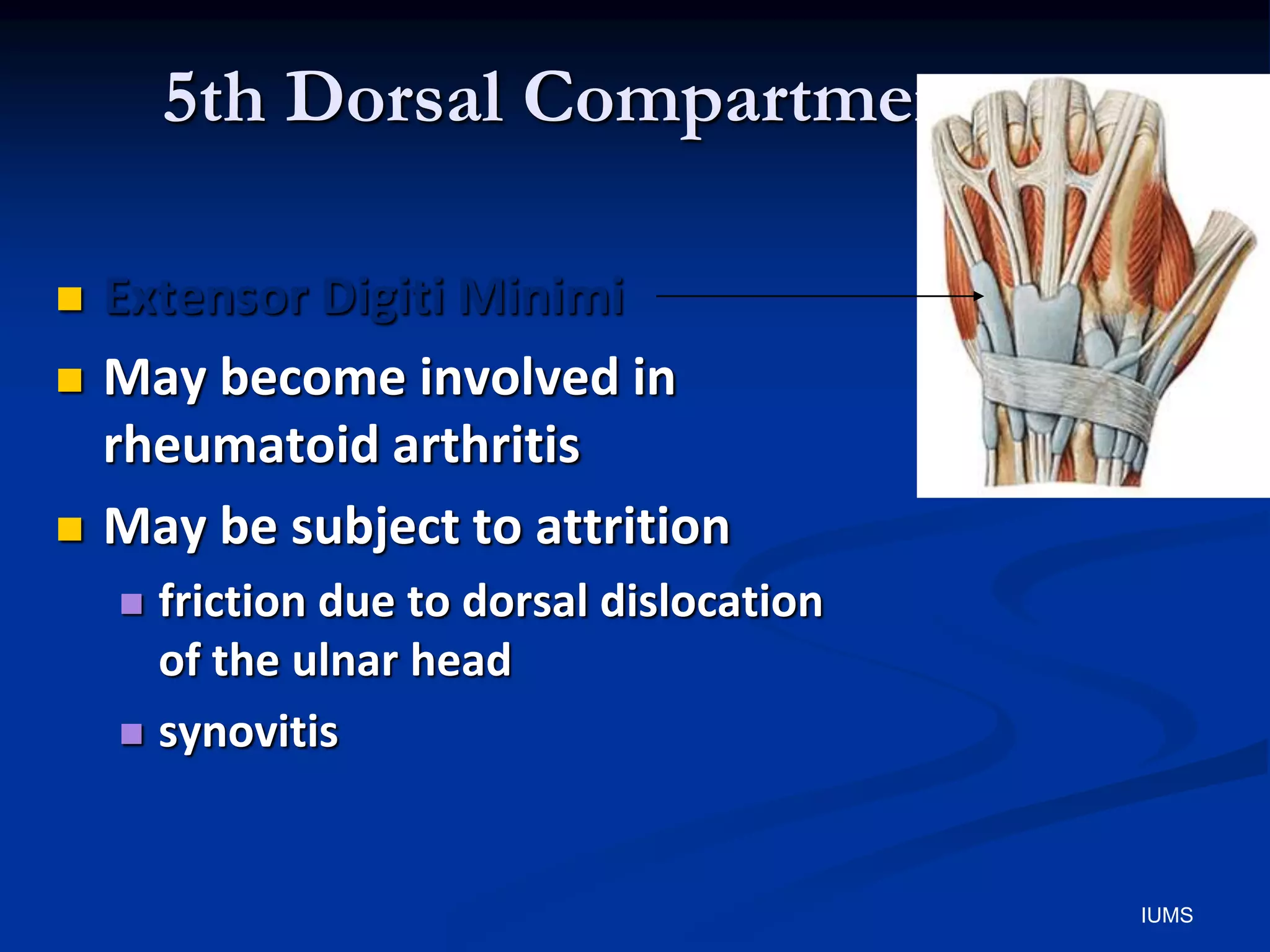 5th Dorsal Compartment
 Extensor Digiti Minimi
 May become involved in
rheumatoid arthritis
 May be subject to attrition
 friction due to dorsal dislocation
of the ulnar head
 synovitis
IUMS
 