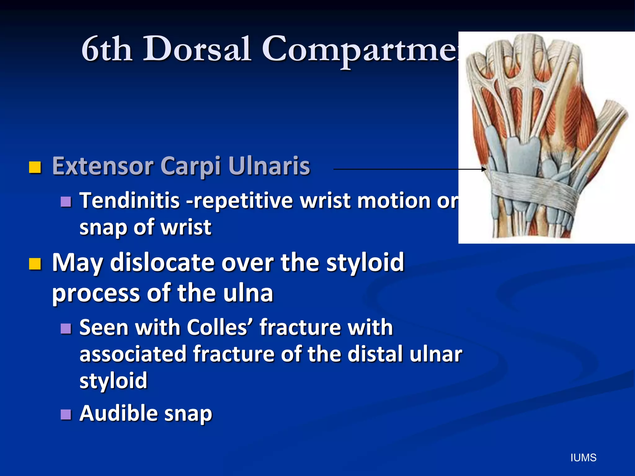 6th Dorsal Compartment
 Extensor Carpi Ulnaris
 Tendinitis -repetitive wrist motion or
snap of wrist
 May dislocate over the styloid
process of the ulna
 Seen with Colles’ fracture with
associated fracture of the distal ulnar
styloid
 Audible snap
IUMS
 