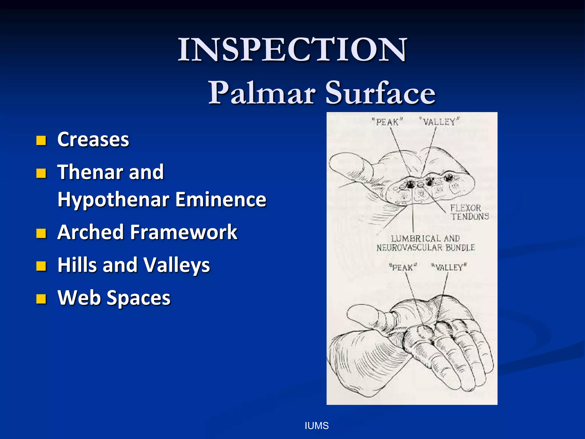INSPECTION
Palmar Surface
 Creases
 Thenar and
Hypothenar Eminence
 Arched Framework
 Hills and Valleys
 Web Spaces
IUMS
 