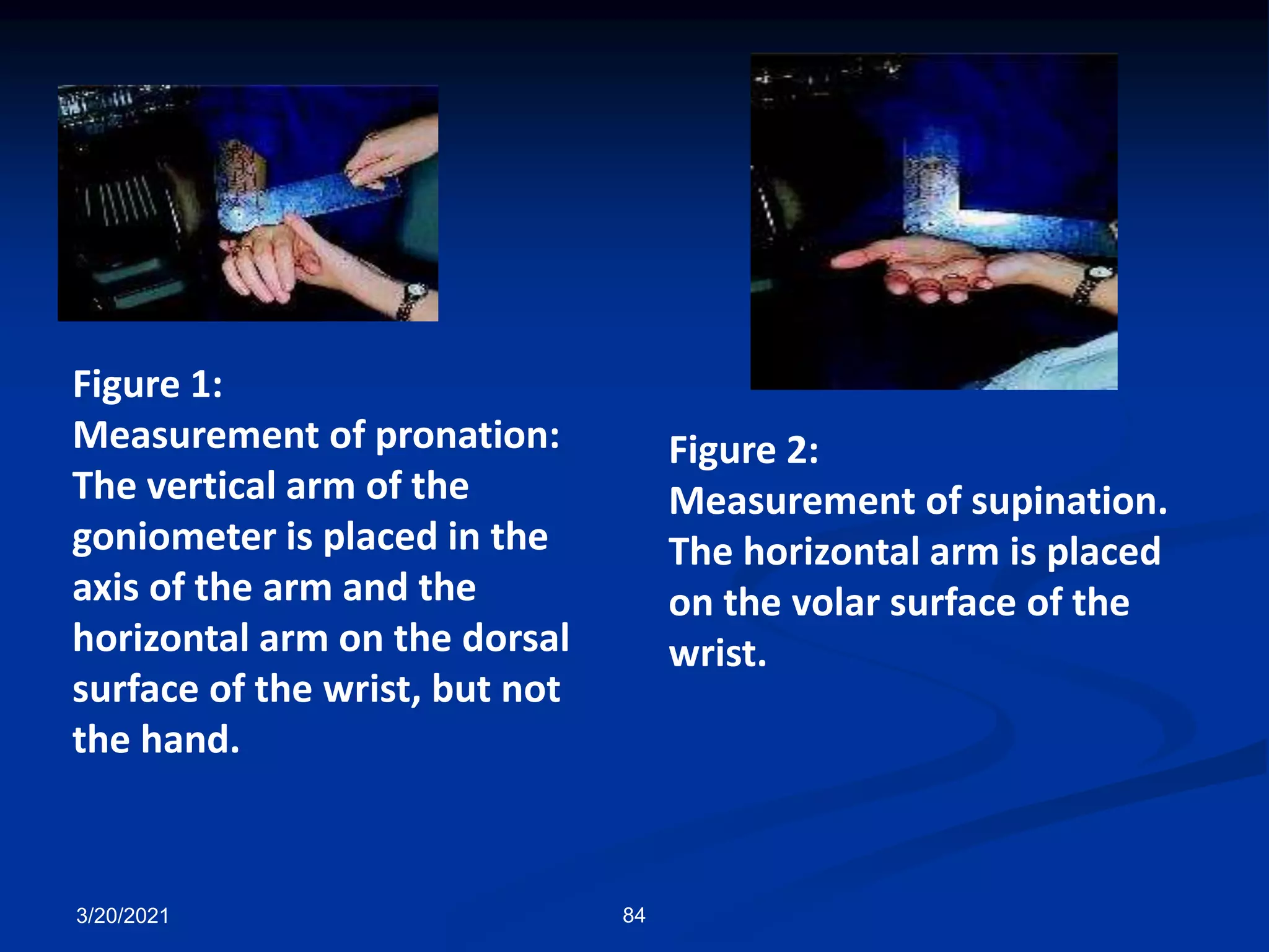 Figure 1:
Measurement of pronation:
The vertical arm of the
goniometer is placed in the
axis of the arm and the
horizontal arm on the dorsal
surface of the wrist, but not
the hand.
Figure 2:
Measurement of supination.
The horizontal arm is placed
on the volar surface of the
wrist.
3/20/2021 84
 