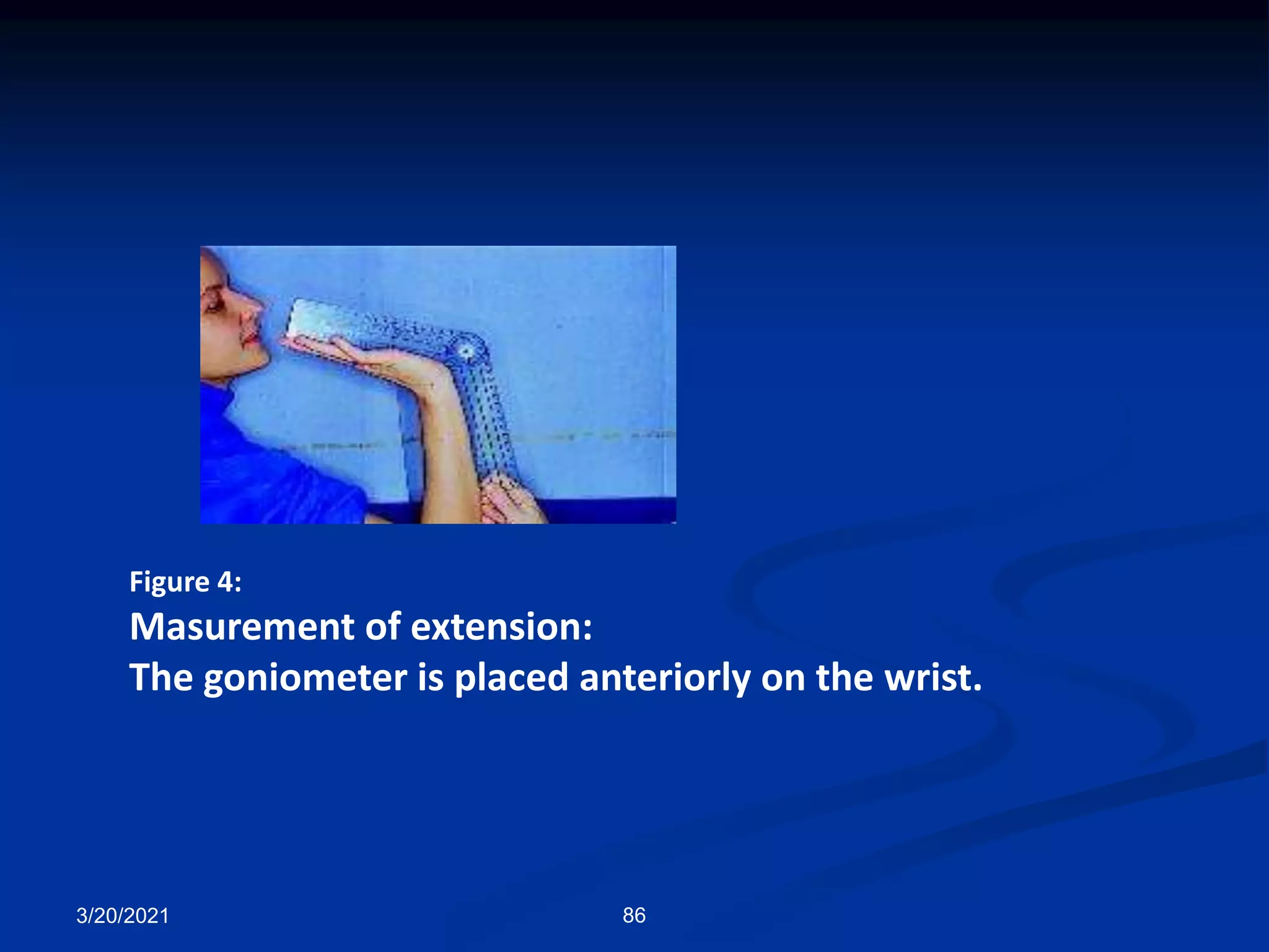 3/20/2021 86
Figure 4:
Masurement of extension:
The goniometer is placed anteriorly on the wrist.
 