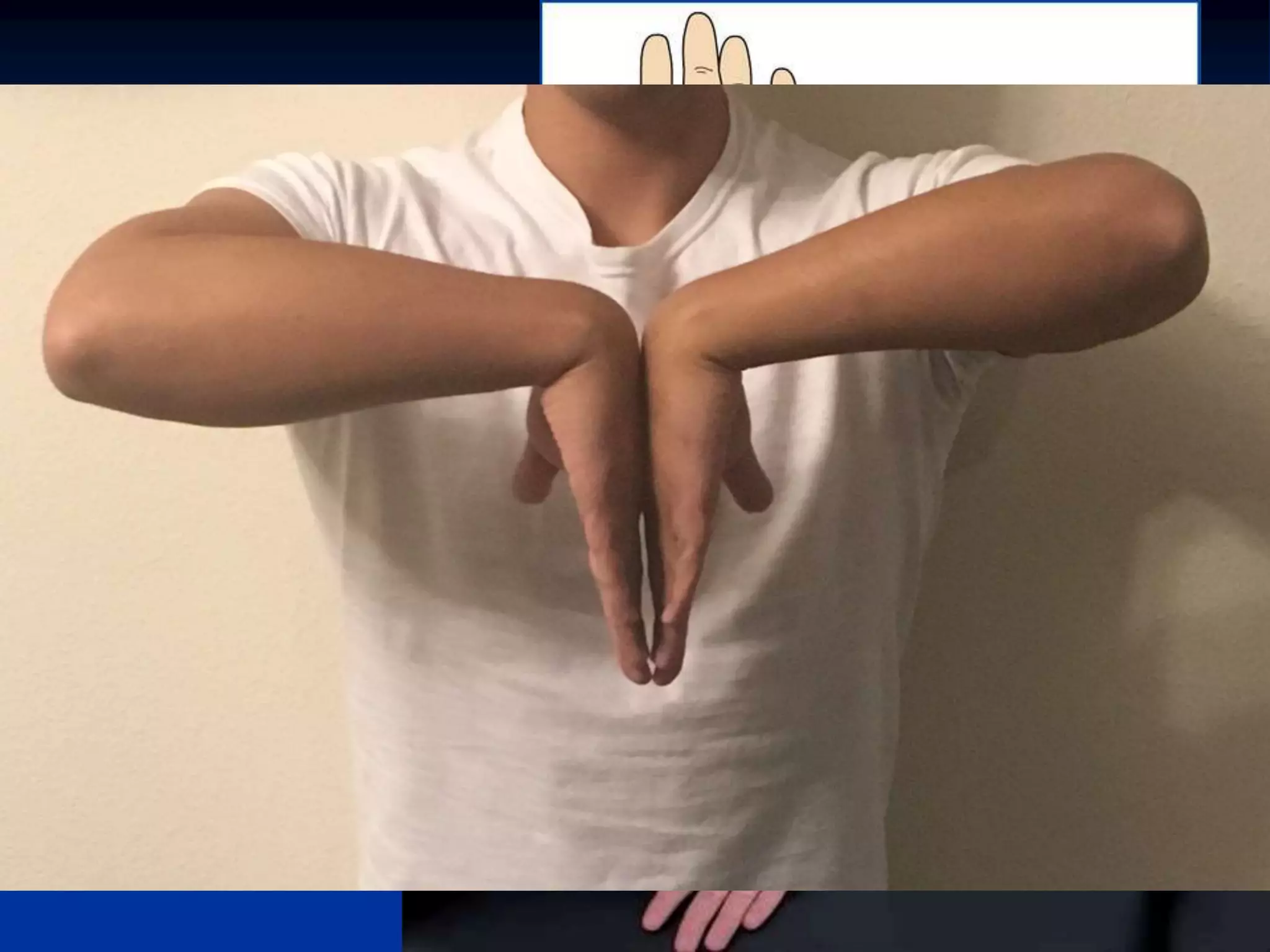 PALPATION of Skin
 Warmth?
 Dryness?
 Anhydrosis= nerve damage
 Scars
IUMS
 