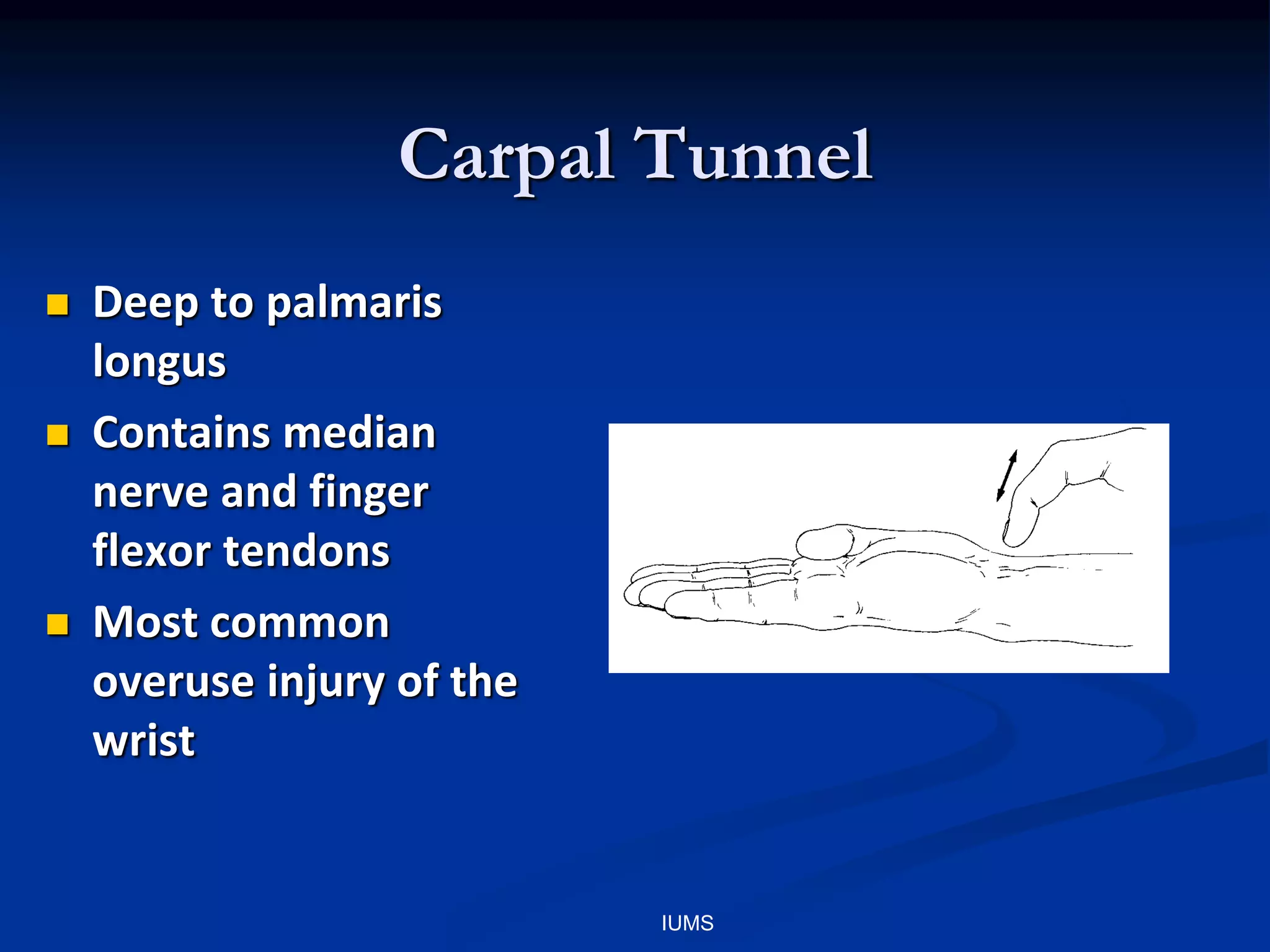 Carpal Tunnel
 Deep to palmaris
longus
 Contains median
nerve and finger
flexor tendons
 Most common
overuse injury of the
wrist
IUMS
 
