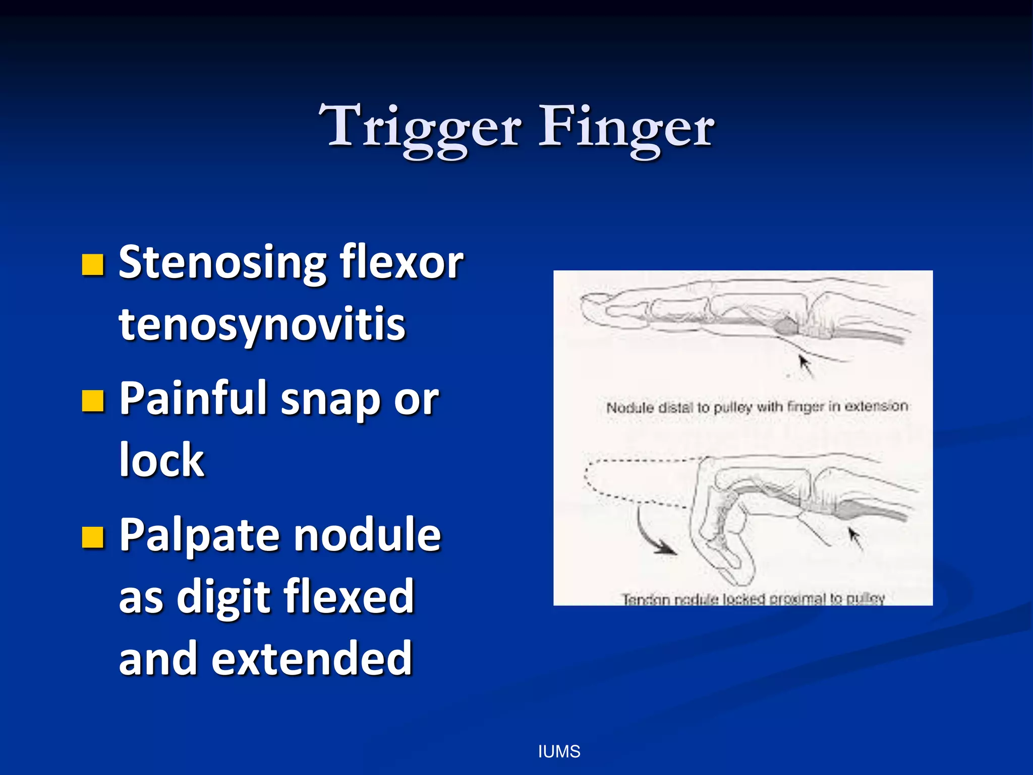 Trigger Finger
 Stenosing flexor
tenosynovitis
 Painful snap or
lock
 Palpate nodule
as digit flexed
and extended
IUMS
 