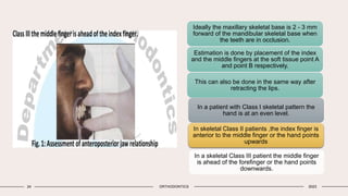 General and extra oral examination orthodontics | PPTX