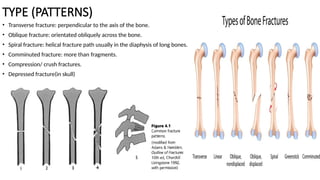 Fracture Pattern Math Comprehensive Overview of Bone Fractures: Types, Diagnosis, Healing ...
