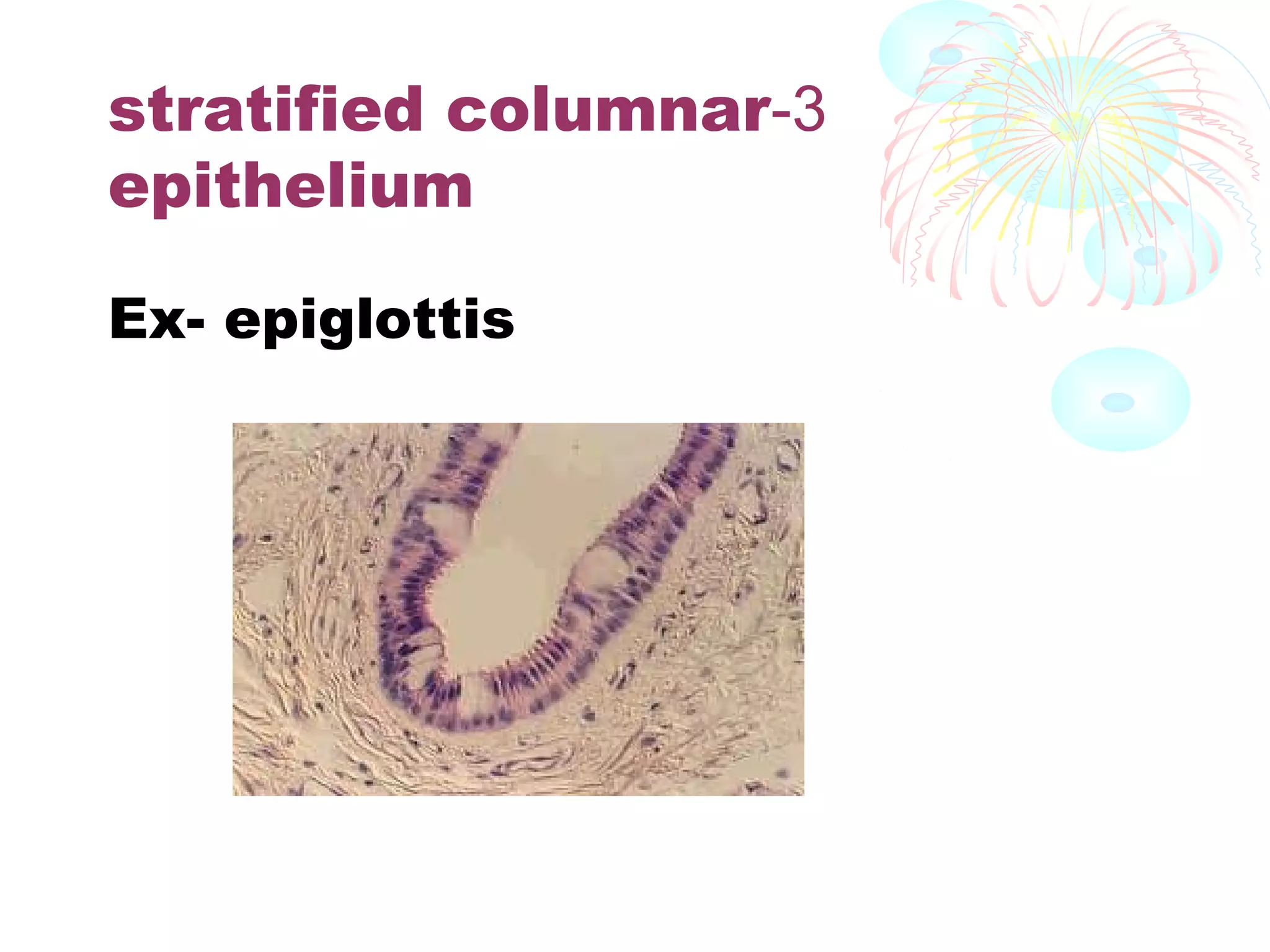 stratified columnar-3
epithelium
Ex- epiglottis

 