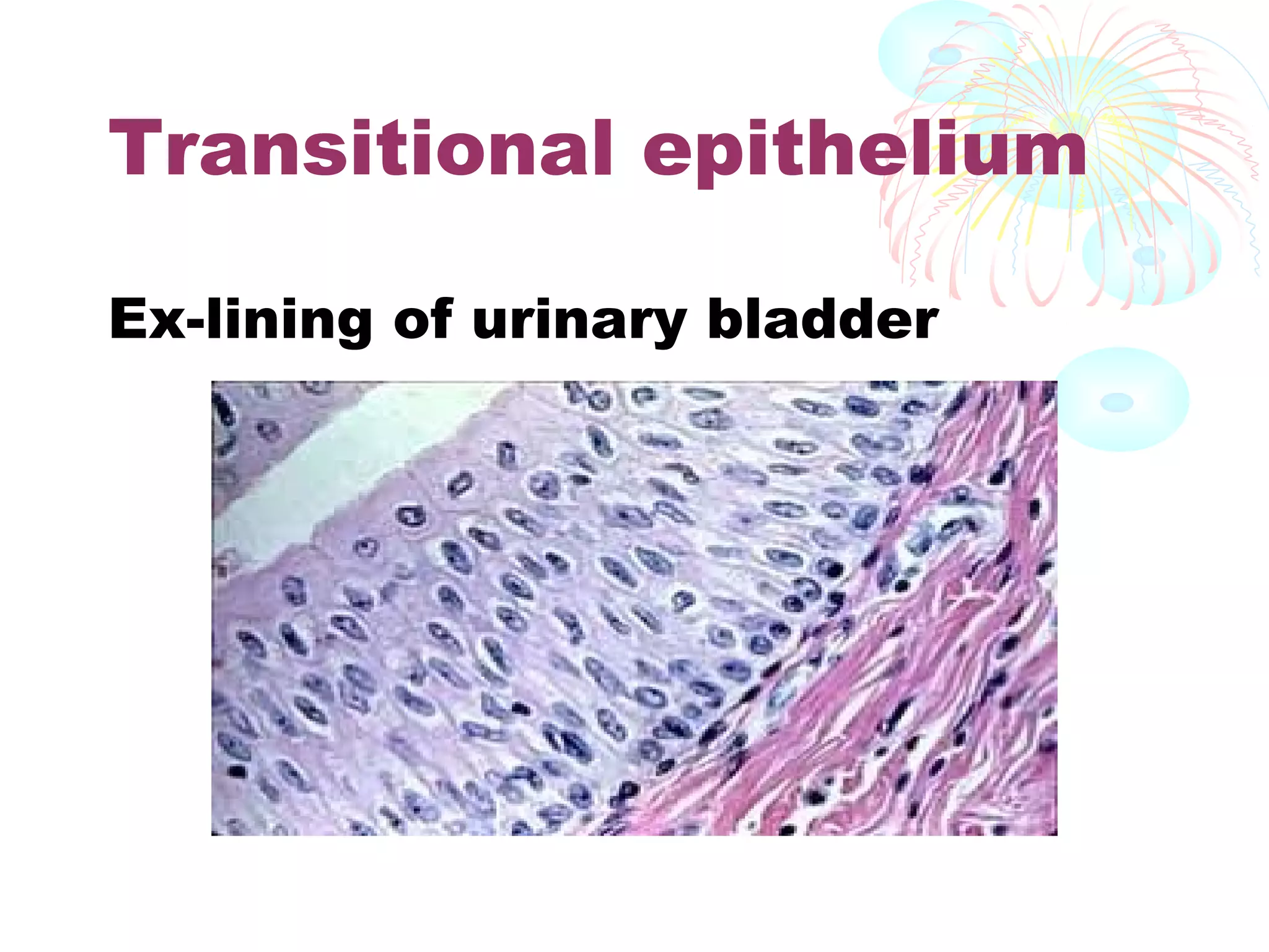 Transitional epithelium
Ex-lining of urinary bladder

 