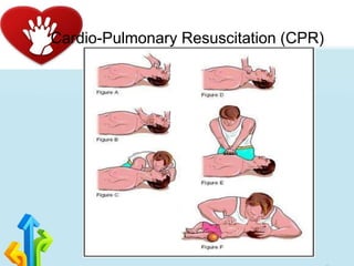 Cardio-Pulmonary Resuscitation (CPR)
 