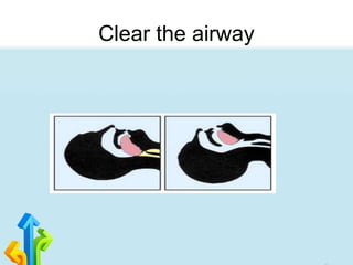 Clear the airway
 
