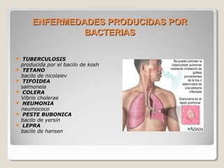 ENFERMEDADES PRODUCIDAS PORENFERMEDADES PRODUCIDAS POR
BACTERIASBACTERIAS
 TUBERCULOSIS
producida por el bacilo de kosh
 TETANO
bacilo de nicolaiev
 TIFOIDEA
salmonela
 COLERA
Vibrio cholerae
 NEUMONIA
neumococo
 PESTE BUBONICA
bacilo de yersin
 LEPRA
bacilo de hansen
 