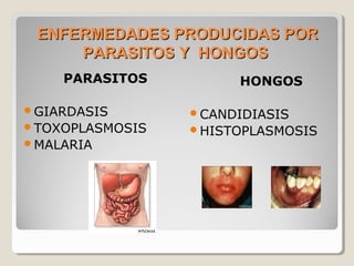 ENFERMEDADES PRODUCIDAS PORENFERMEDADES PRODUCIDAS POR
PARASITOS Y HONGOSPARASITOS Y HONGOS
PARASITOS
GIARDASIS
TOXOPLASMOSIS
MALARIA
HONGOS
CANDIDIASIS
HISTOPLASMOSIS
 