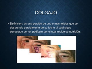 COLGAJO
• Definicion: es una porción de uno o mas tejidos que se
desprende parcialmente de su lecho al cual sigue
conectado por un pedículo por el cual recibe su nutrición.
 