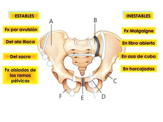 ESTABLESESTABLES INESTABLESINESTABLES
Fx Malgaigne
En libro abierto
En asa de cubo
En horcajadas
Fx por avulsión
Del ala iliaca
Del sacro
Fx aisladas de
las ramas
pélvicas
 