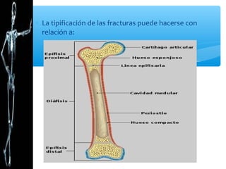 ∗ La tipificación de las fracturas puede hacerse con
relación a:
 
