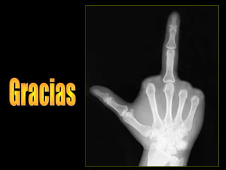 Generalidades de las fracturas.