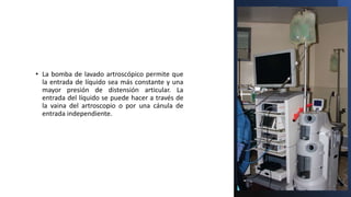 • La bomba de lavado artroscópico permite que
la entrada de líquido sea más constante y una
mayor presión de distensión articular. La
entrada del líquido se puede hacer a través de
la vaina del artroscopio o por una cánula de
entrada independiente.
 