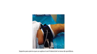 Soporte para pierna que se sujeta al carril lateral de la mesa de quirófano.
 