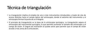 Técnica de triangulación
• La triangulación implica el empleo de uno o más instrumentos introducidos a través de vías de
acceso distintas hacia el campo óptico del artroscopio, donde el extremo del instrumento y el
artroscopio forman la punta de un triángulo.
• El principio de triangulación es la base de la artroscopia quirúrgica. La triangulación separa el
artroscopio del instrumental quirúrgico, lo que permite aumentar el tamaño del artroscopio y el
campo de visión. El ángulo de inclinación se puede variar para permitir que el campo de visión
acceda a más zonas de la articulación.
 