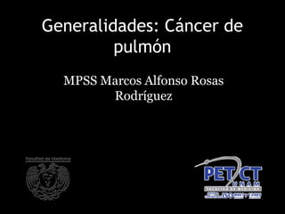 Generalidades: Cáncer de
pulmón
MPSS Marcos Alfonso Rosas
Rodríguez
 