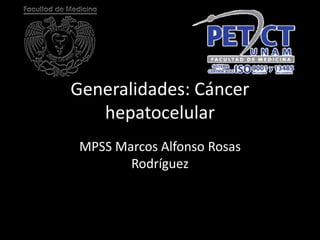 Generalidades: Cáncer
hepatocelular
MPSS Marcos Alfonso Rosas
Rodríguez
 