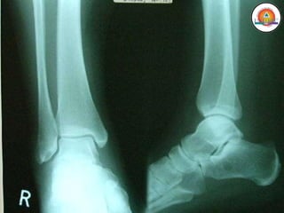 GENERALIDADES DE ANATOMIA 1ER. AÑO-1.pdf