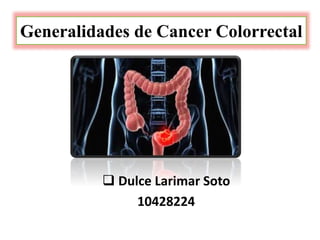 Generalidades de Cancer Colorrectal
 Dulce Larimar Soto
10428224
 
