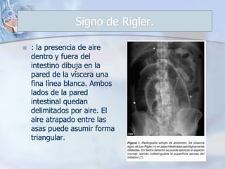 Generalidades de cirugía laparoscópica | PPTX