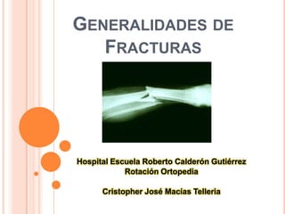 GENERALIDADES DE
   FRACTURAS




Hospital Escuela Roberto Calderón Gutiérrez
            Rotación Ortopedia

      Cristopher José Macías Telleria
 