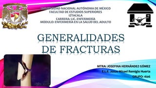 MTRA: JOSEFINA HERNÁNDEZ GÓMEZ
E.L.E. Josue Misael Remigio Huerta
GRUPO: 1606
GENERALIDADES
DE FRACTURAS
 
