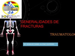 GENERALIDADES DE
FRACTURAS
INT. RONALDO DANIEL ALCONZ CESPEDES
TRAUMATOLOG
 