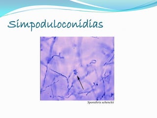 Simpoduloconidias
Sporothrix schenckii
 