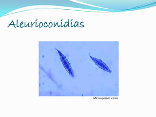 Aleurioconidias
Microsporum canis
 