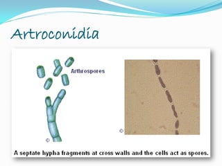 Artroconidia
 