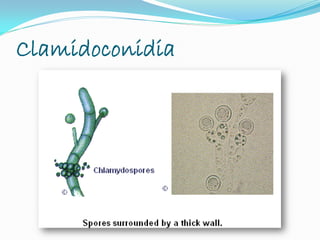 Clamidoconidia
 
