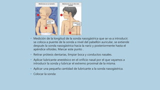 • Medición de la longitud de la sonda nasogástrica que se va a introducir;
se coloca a puente de la sonda a nivel del pabellón auricular, se extiende
después la sonda nasogástrica hacia la nariz y posteriormente hasta el
apéndice xifoides. Marcar este punto .
• Retirar prótesis dentarias, limpiar boca y conductos nasales.
• Aplicar lubricante anestésico en el orificio nasal por el que vayamos a
introducir la sonda y lubricar el extremo proximal de la misma.
• Aplicar una pequeña cantidad de lubricante a la sonda nasogástrica.
• Colocar la sonda:
 