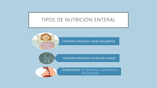 TIPOS DE NUTRICIÓN ENTERAL
1.Nutrición enteral por sonda nasogástrica
1.Nutrición enteral por sonda naso enteral
1.Enterostomía: Faringostomia, Gastrostomía y
Yeyunostomía
 