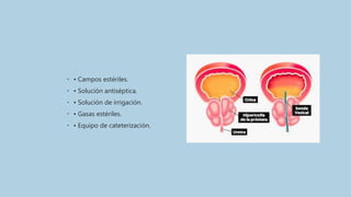• • Campos estériles.
• • Solución antiséptica.
• • Solución de irrigación.
• • Gasas estériles.
• • Equipo de cateterización.
 