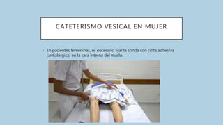 CATETERISMO VESICAL EN MUJER
• En pacientes femeninas, es necesario fijar la sonda con cinta adhesiva
(antialérgica) en la cara interna del muslo.
 