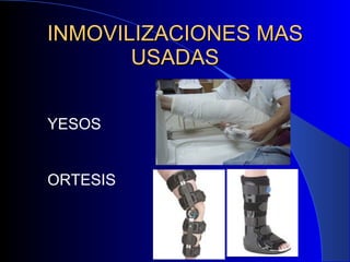 INMOVILIZACIONES MAS USADAS YESOS ORTESIS 