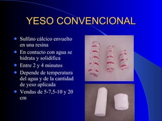 YESO CONVENCIONAL Sulfato cálcico envuelto en una resina En contacto con agua se hidrata y solidifica Entre 2 y 4 minutos Depende de temperatura del agua y de la cantidad de yeso aplicada Vendas de 5-7,5-10 y 20 cm 