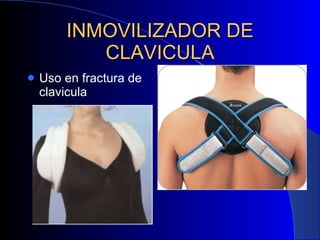 INMOVILIZADOR DE CLAVICULA Uso en fractura de clavicula 