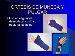 ORTESIS DE MUÑECA Y PULGAR Uso en esguinces de muñeca y pulgar, fracturas estables 