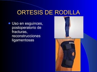 ORTESIS DE RODILLA Uso en esguinces, postoperatorio de fracturas, reconstrucciones ligamentosas 