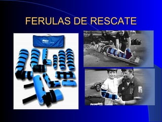 FERULAS DE RESCATE 