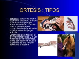 ORTESIS : TIPOS Estáticas : para: sostener el segmento afectado, prevenir contracturas y proteger áreas lesionadas. También para la prevención o corrección de deformidades o limitaciones del juego articular. Dinámica s: para facilitar el ejercicio terapéutico y el uso funcional de la extremidad. Tiene por objeto la ayuda o suplencia de una función deficitaria o ausente 