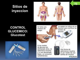 Sitios de
inyeccion
CONTROL
GLUCEMICO:
Glucotest
23
 